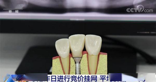 486938d15efd40f3a1965ff85c0de959